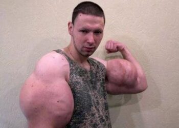 У него плохие анализы: трэш-блогер «Руки-базуки» нуждается в операциях