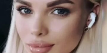 Избитая до отека мозга модель Тартанова забыла о существовании родителей и ребенка