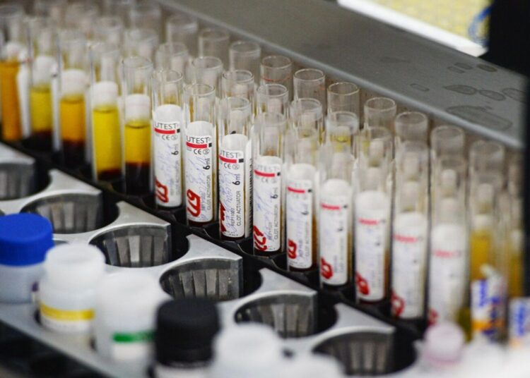 Актуальные подсчеты показали, что каждый десятый россиянин болеет ВИЧ