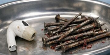 От наушников до гвоздей: врачи показали неожиданные находки в пациентах